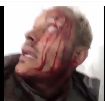 ENCURRALADO – O dissidente OSCAR PEREZ deseja se entregar mas corre risco de ser assassinado