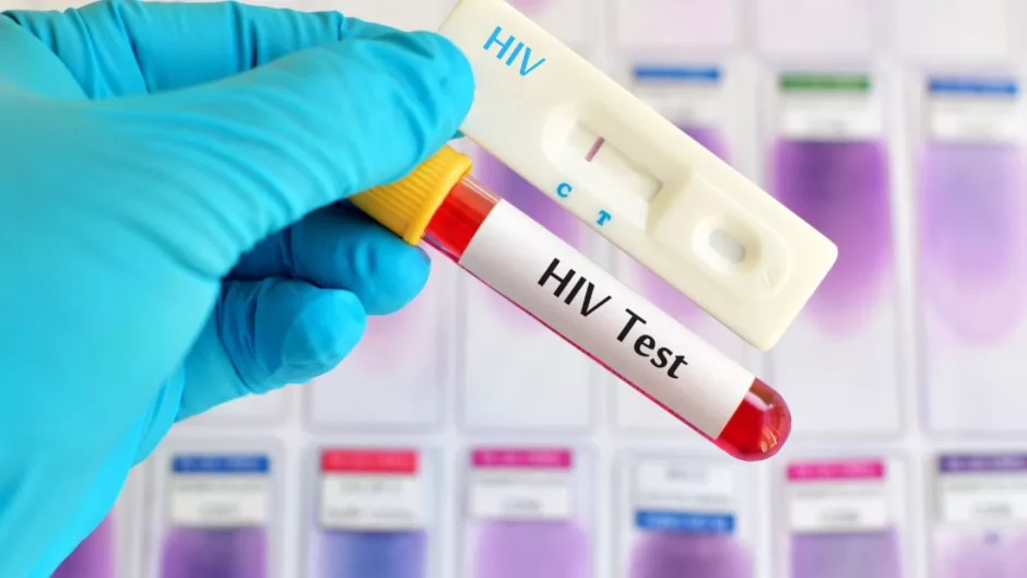 Justiça determina fim do teste de HIV para candidatos do concurso da Polícia Militar do Rio de Janeiro; entenda a decisão