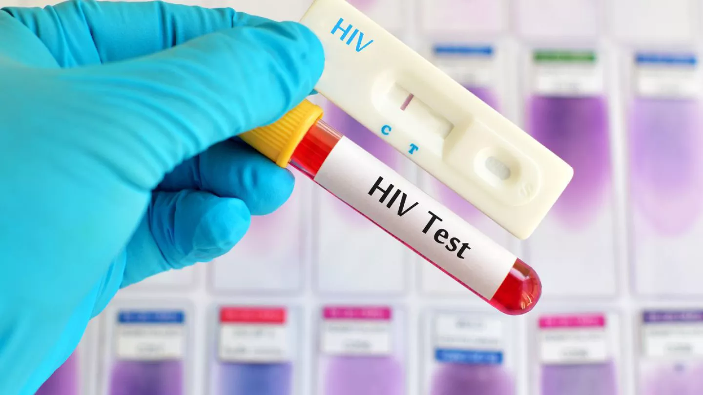 Justiça determina fim do teste de HIV para candidatos do concurso da Polícia Militar do Rio de Janeiro; entenda a decisão