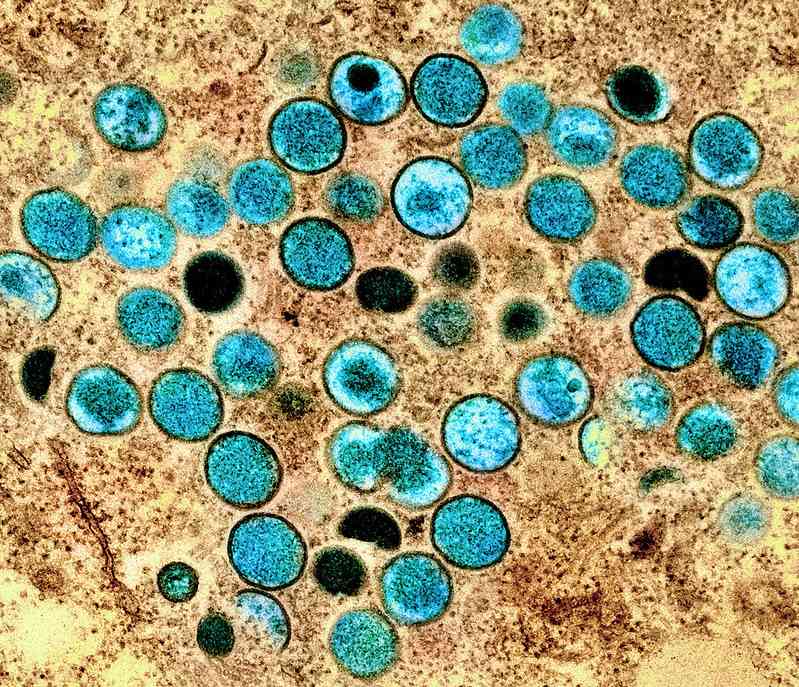 OMS declara emergência sanitária global por novo vírus: O que você precisa saber sobre a Mpox